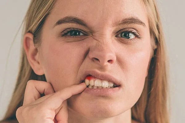 What is gum disease?